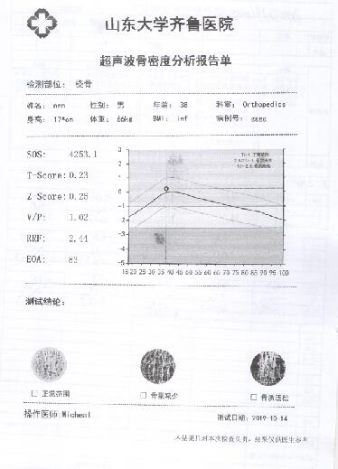 骨密度儀器上的打印機能夠打印彩色報告單簡易懂時刻掌握自己身體狀況