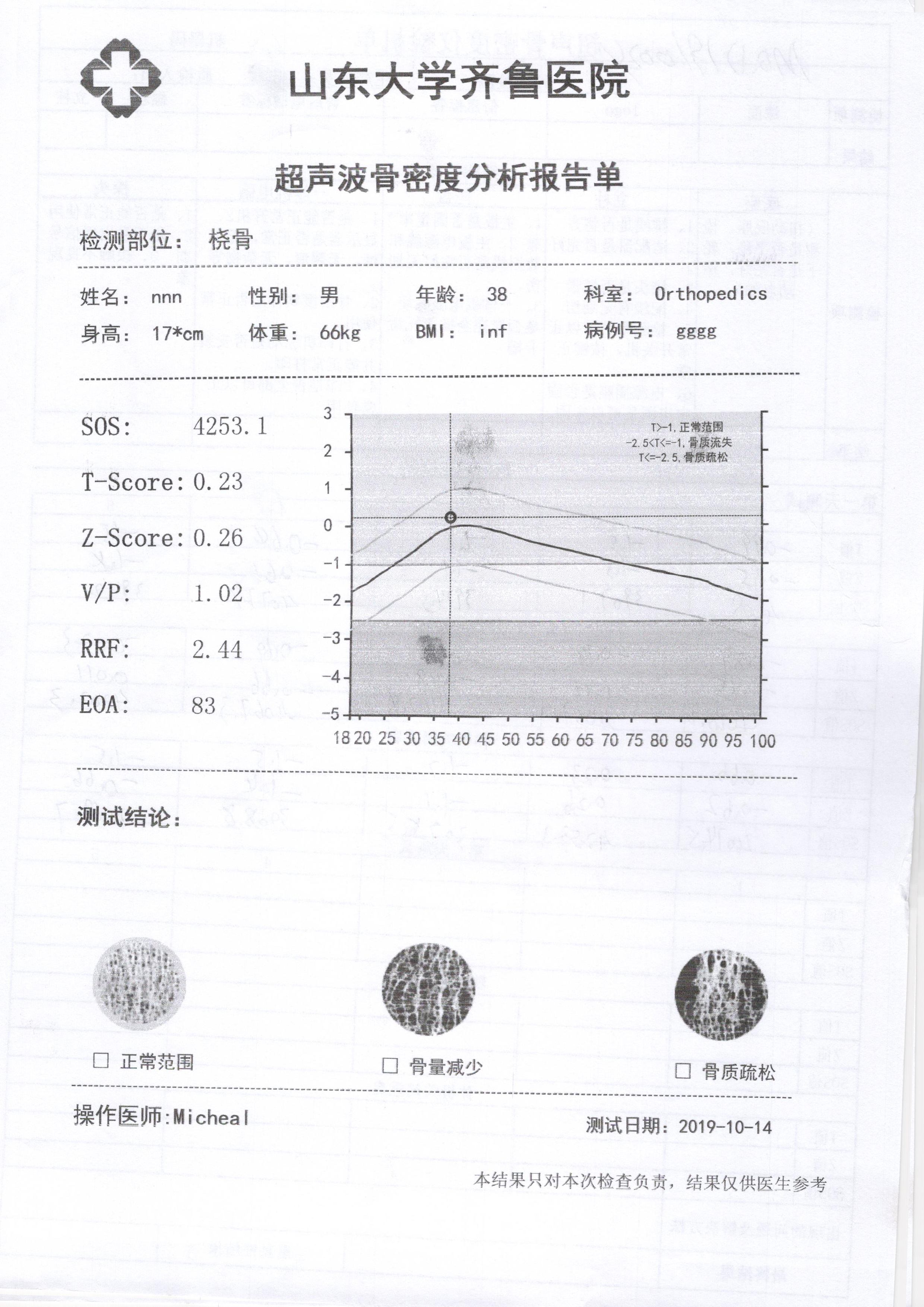 便攜式骨密度儀小型款生產(chǎn)廠家介紹：怎么做骨密度檢查用什么儀器？