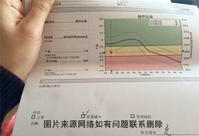 寧夏骨密度檢測儀廠家直銷看看醫(yī)生是如何解讀骨密度檢測報告單上的數(shù)值