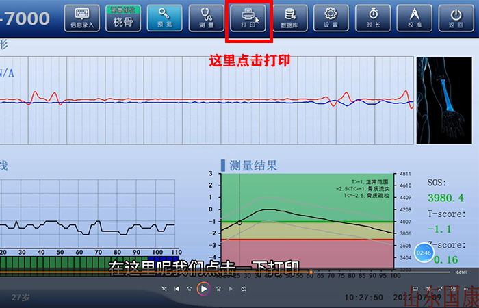 骨密度儀品牌詳細介紹：醫(yī)院在打印結果是該如何操作？內附改打印設置！