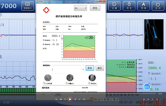 骨密度儀品牌詳細介紹：醫(yī)院在打印結果是該如何操作？內附改打印設置！