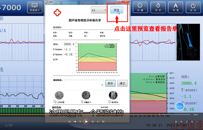 骨密度儀品牌詳細介紹：醫(yī)院在打印結果是該如何操作？內附改打印設置！