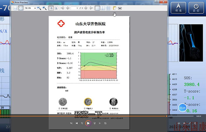 骨密度儀品牌詳細介紹：醫(yī)院在打印結果是該如何操作？內附改打印設置！