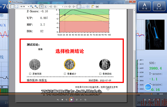 骨密度儀品牌詳細介紹：醫(yī)院在打印結果是該如何操作？內附改打印設置！