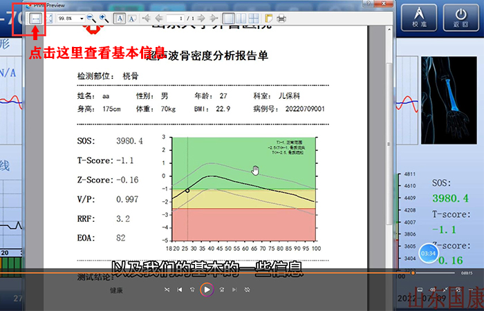 骨密度儀品牌詳細介紹：醫(yī)院在打印結果是該如何操作？內附改打印設置！