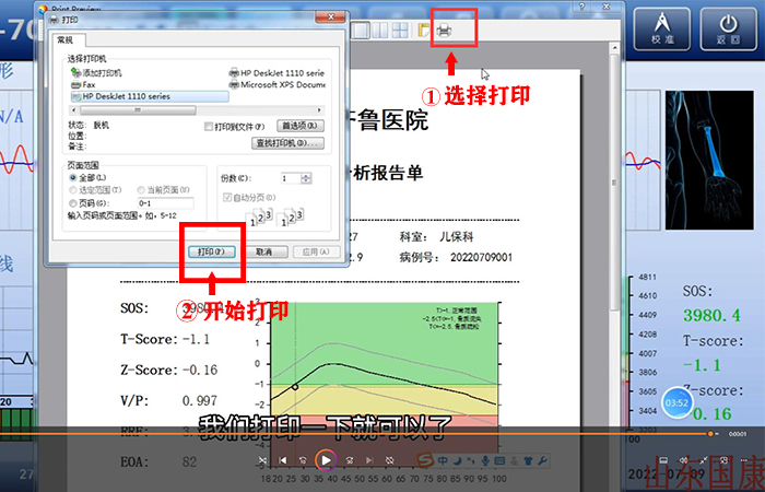 骨密度儀品牌詳細介紹：醫(yī)院在打印結果是該如何操作？內附改打印設置！